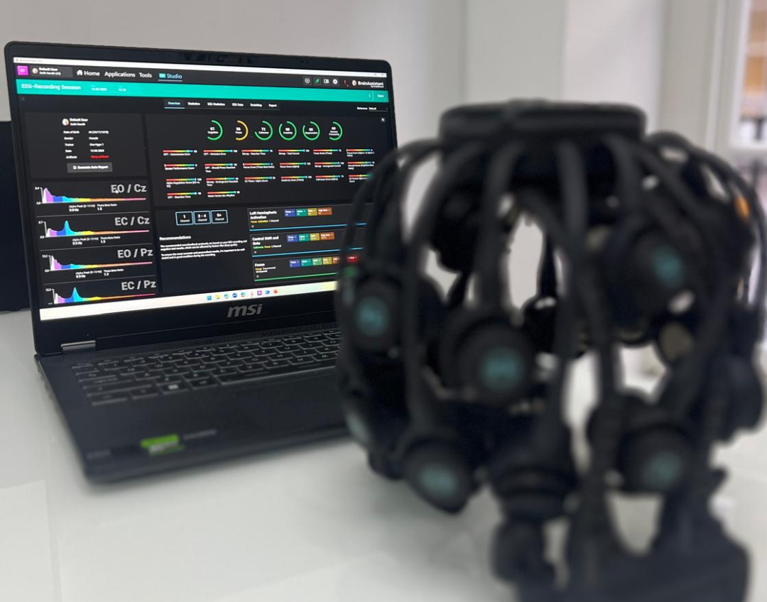 Brain X 360 Mapping Test